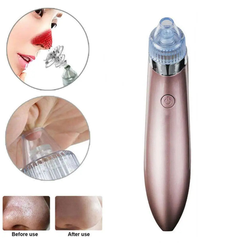Rose Gold Electric Blackhead Vacuum with Strong Suction