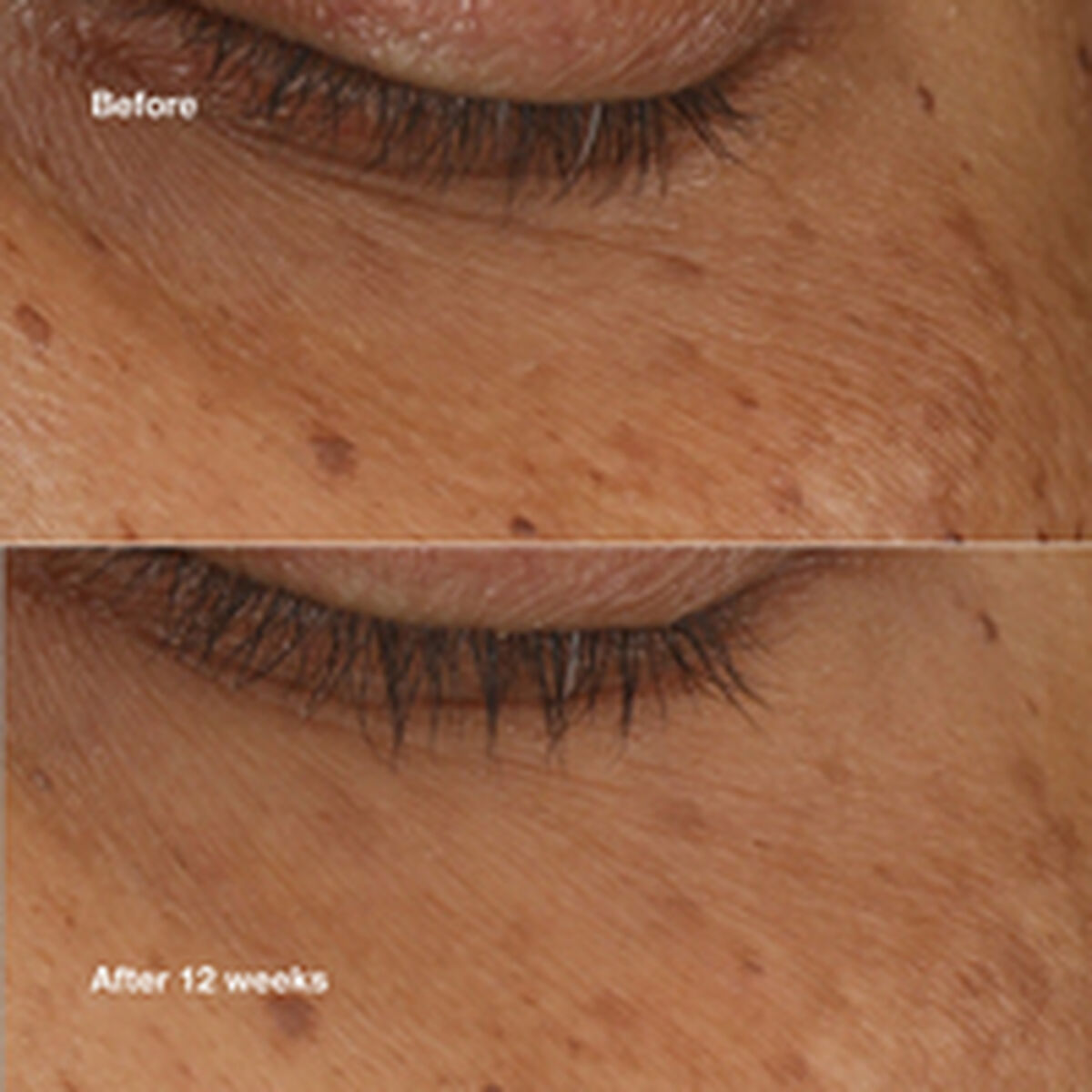 Illuminating Serum Clinique ALL ABOUT EYES 10 ml-3
