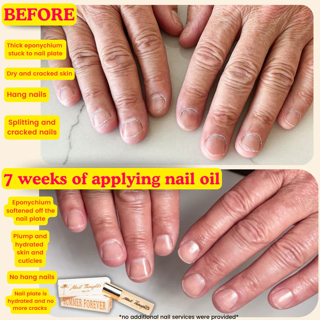 Nail Thoughts - Summer Forever Nail Oil 10ml-2