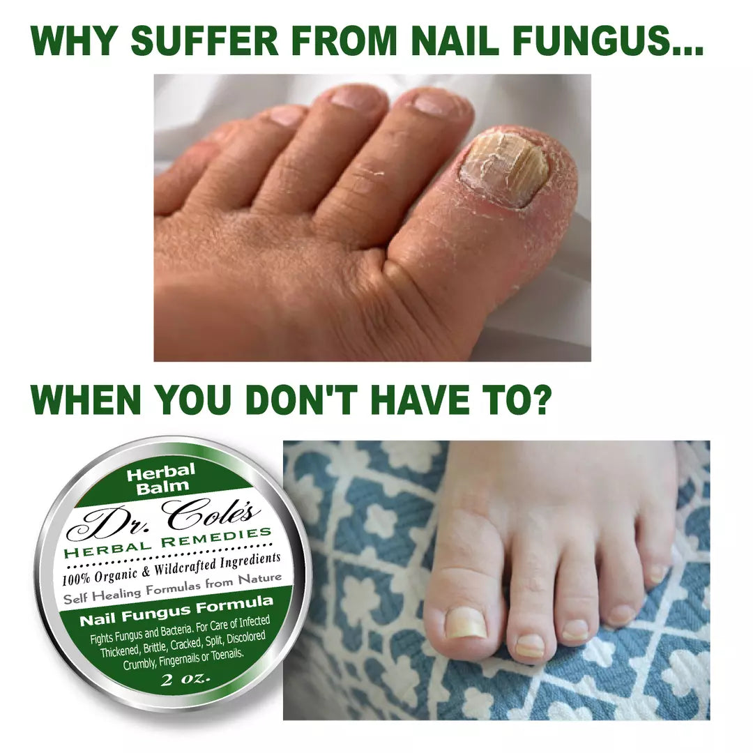 Dr. Cole's Nail Fungus Balm SixPak-4