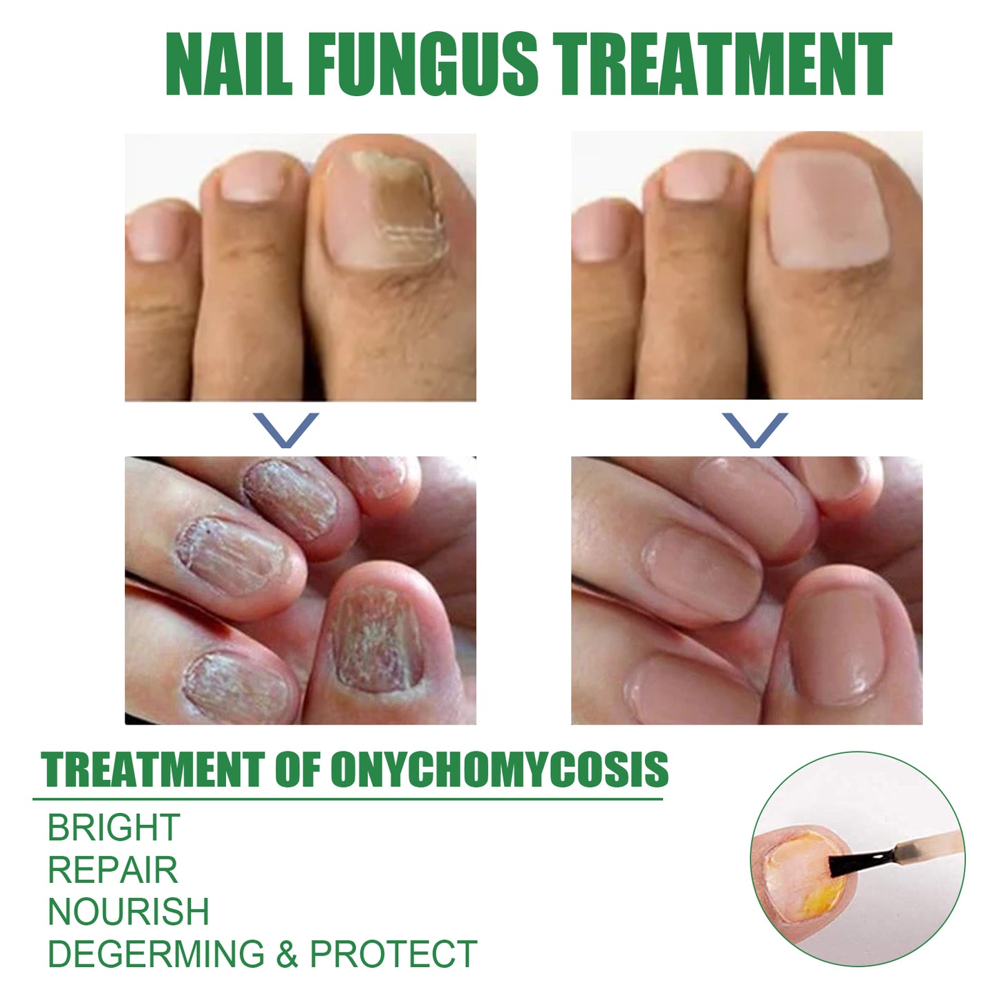 Nail Repair Solution Tea Tree Oil Essence Gentle Nourishing Manicure Cleansing Soft Nail Care Solution