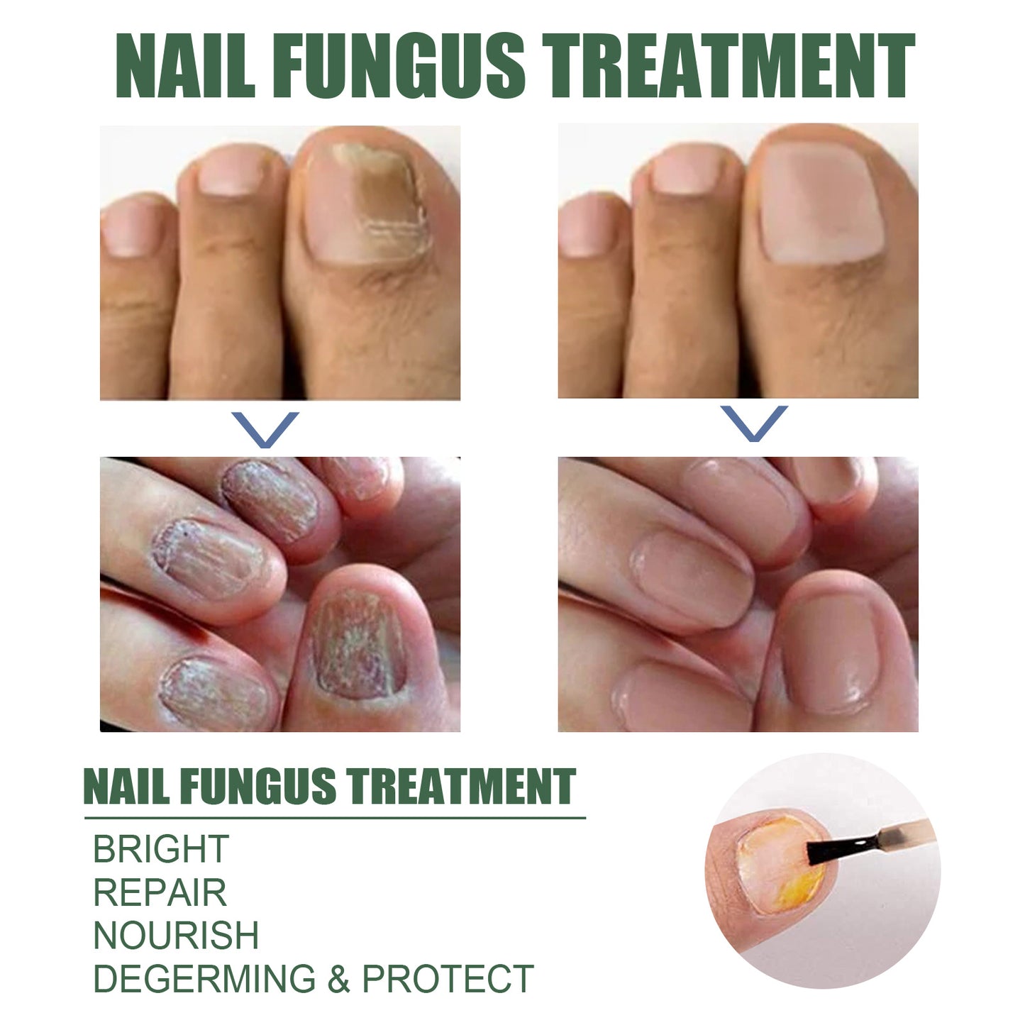 EELHOE Nail Care Liquid (30ml) Gentle Cleaning, Hydrating And Moisturizing Liquid For Thick And Soft Nails On The Surface Of Hands And Feet
