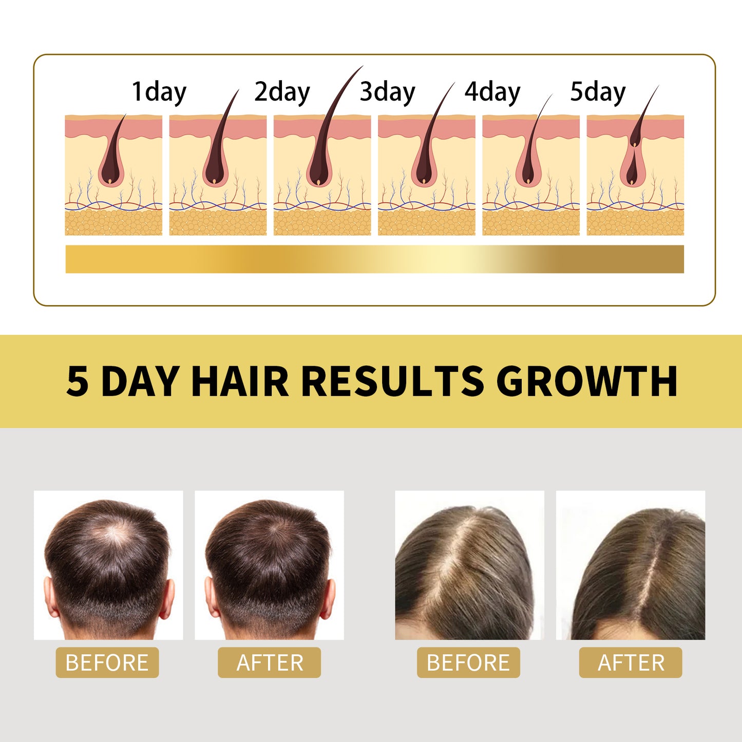 OUHOE Ginger Dense Hair Shampoo, Moisturizes Reduces Itchiness, Strengthens Dense And Fluffy Hair Care Shampoo