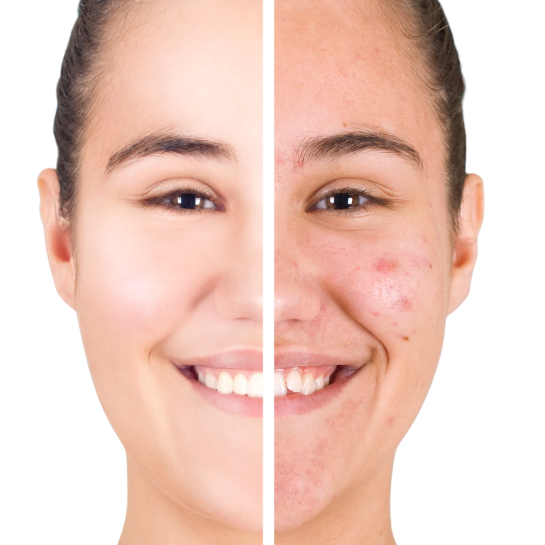 Rejuvenating Anti-Acne Organic Facial Scrub-2