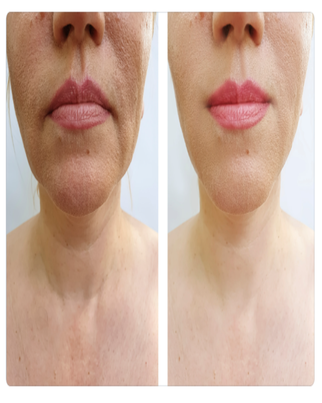 ORGANIC NECK RENEWAL CREAM - For Women-2