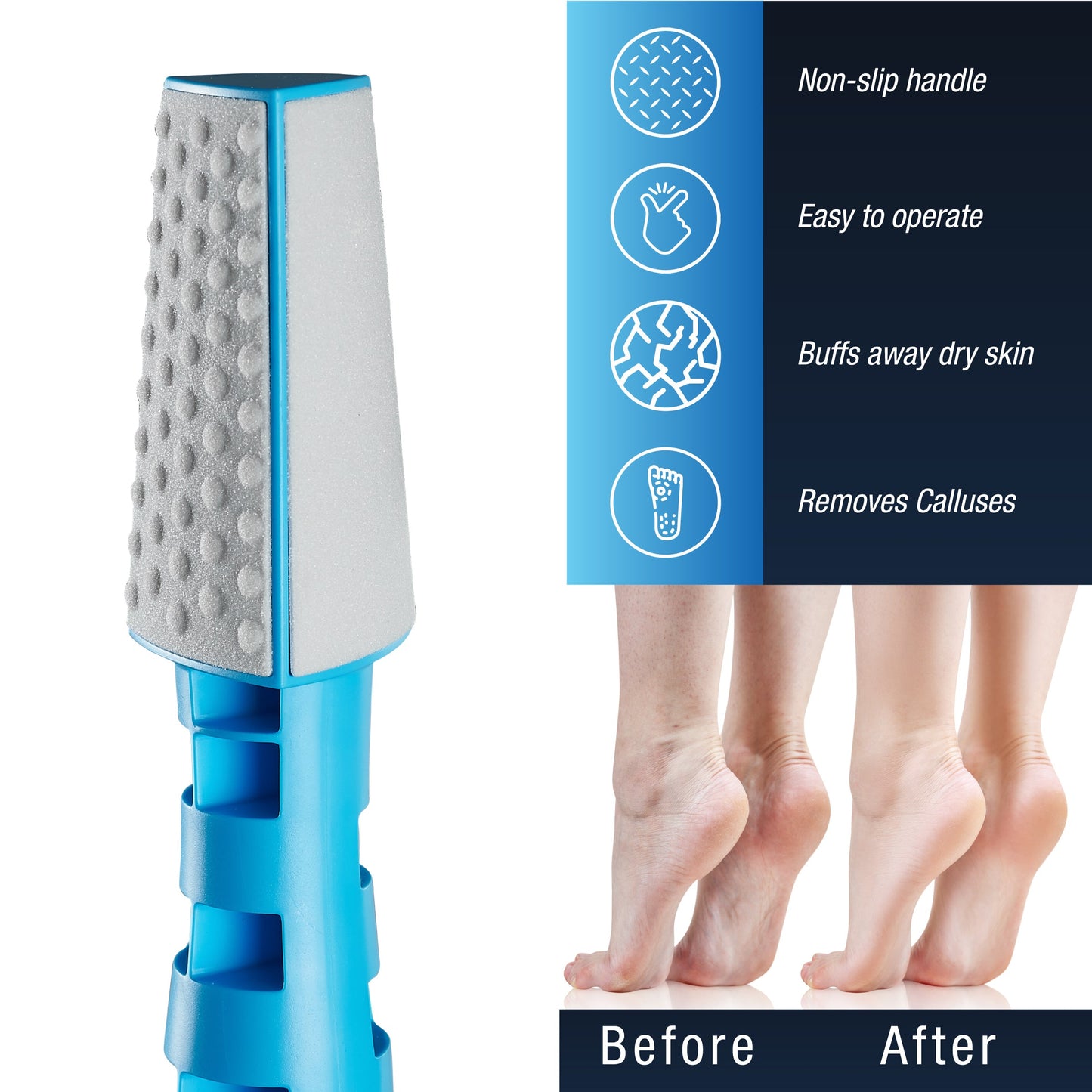 3 In 1 Callus Remover-1