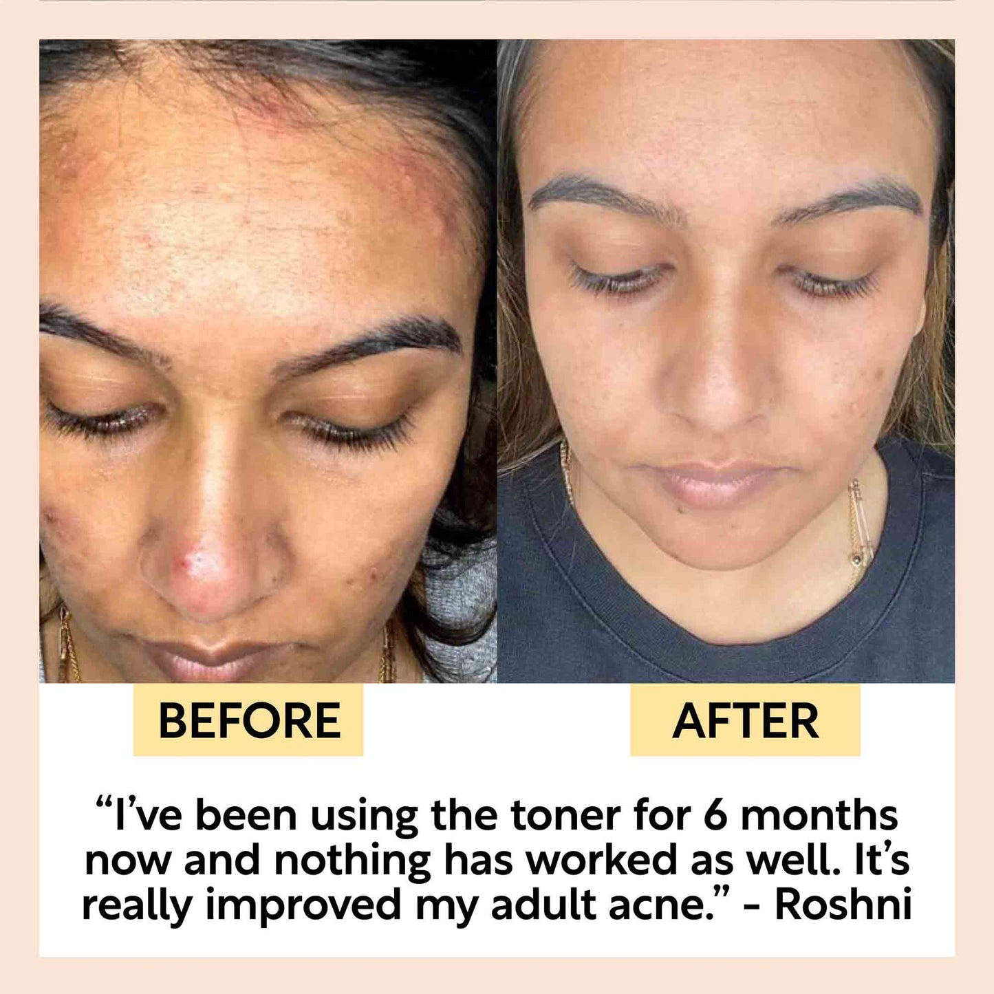 Face Toner with Hyaluronic Acid - Travel Size