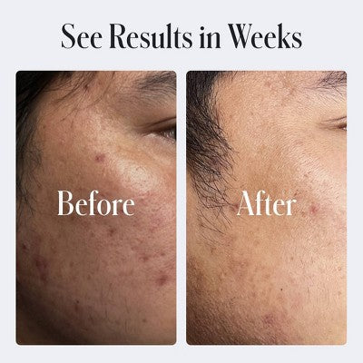 Geologie Clear System Clear Skin Face Cream 2 fl oz EXP 05/2026 - Imperfect Box