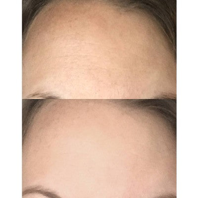 derma e Pure Biome Face Moisturizing Cream 2 fl oz - Imperfect Box