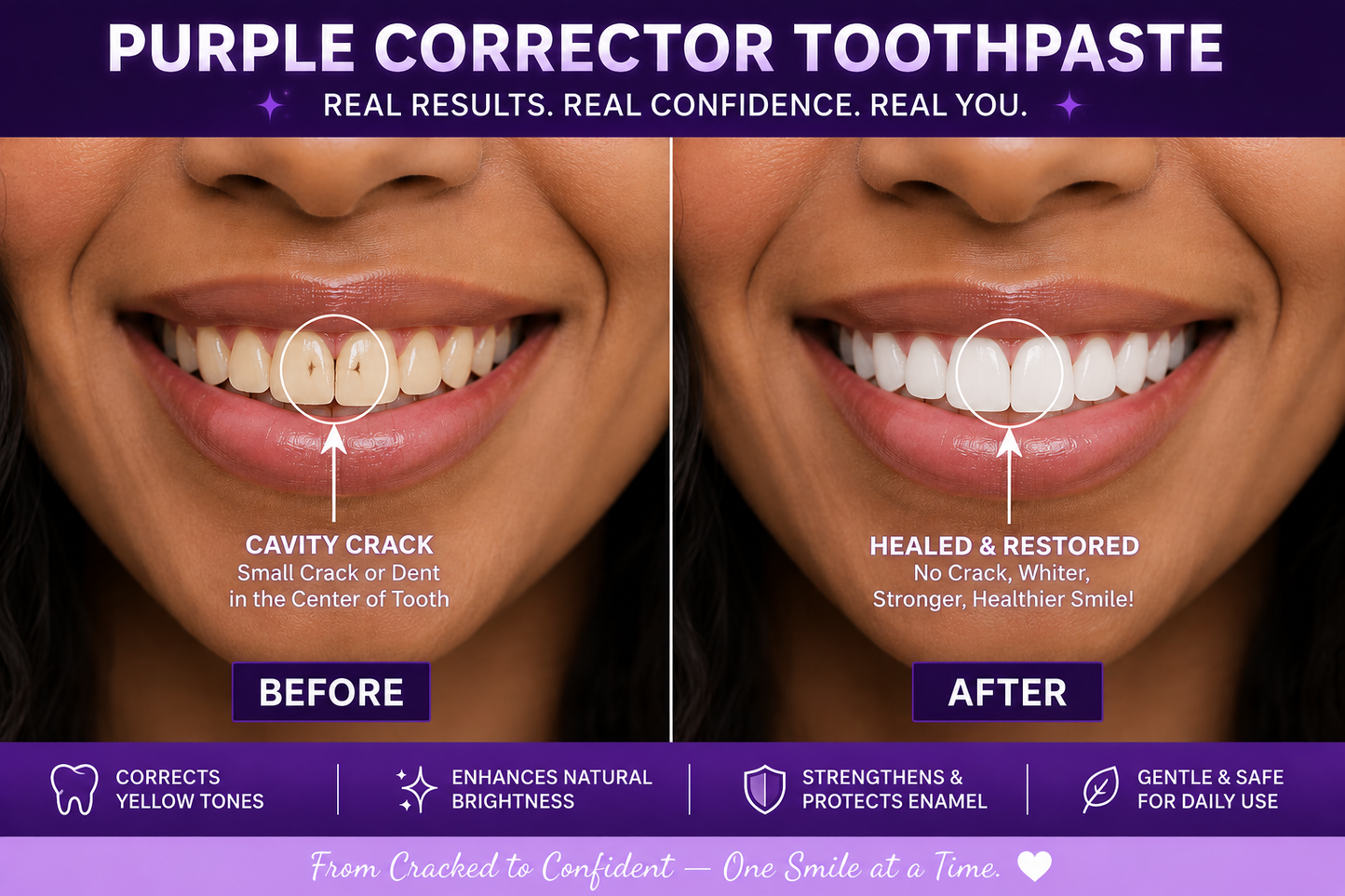 Before-and-after comparison graphic for purple corrector toothpaste, showing a close-up of a smiling person's teeth with a crack on the left and a healed restored smile on the right, with text labels and feature icons on a purple background. Jaysuing Purple Corrector Toothpaste – Purple Whitening Toothpaste for Teeth Whitening, Stain Removal & Fresh Breath