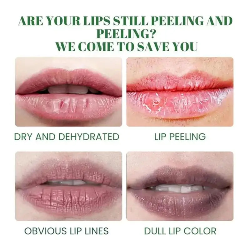 Comparison of dry and dehydrated, lip peeling, obvious lip lines, and dull lip color on lips with text asking if lips are still peeling and offering a solution.