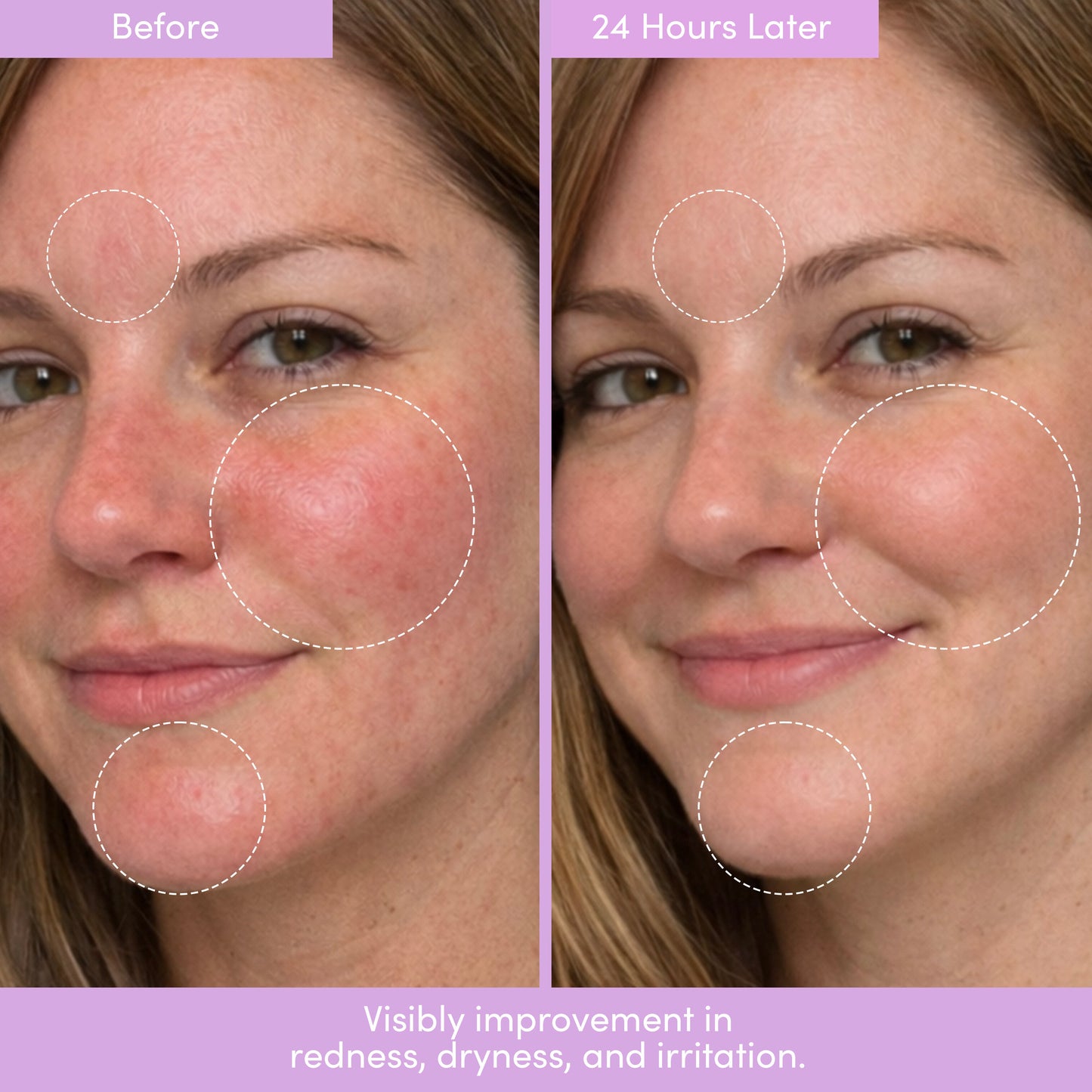 THIRST TRAP Barrier Repair Cream + SPF Ultra-Hydration Bundle