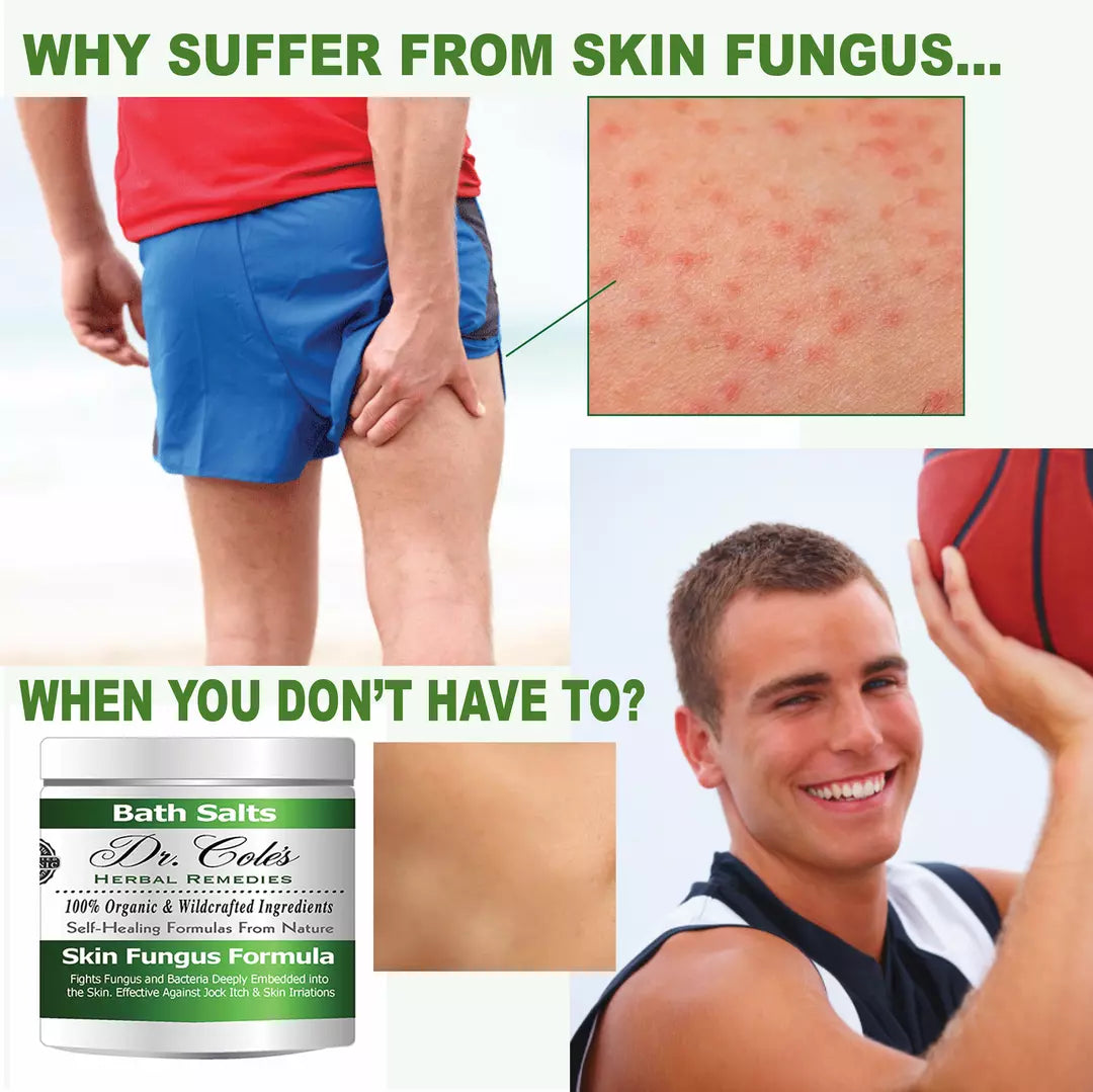11 - Dr. Cole’s Organic Anti-fungal Skin Soaking Salts