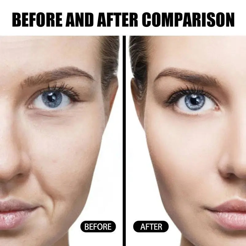 Anti-aging Skin Rejuvenation Firming Water Bank Set
