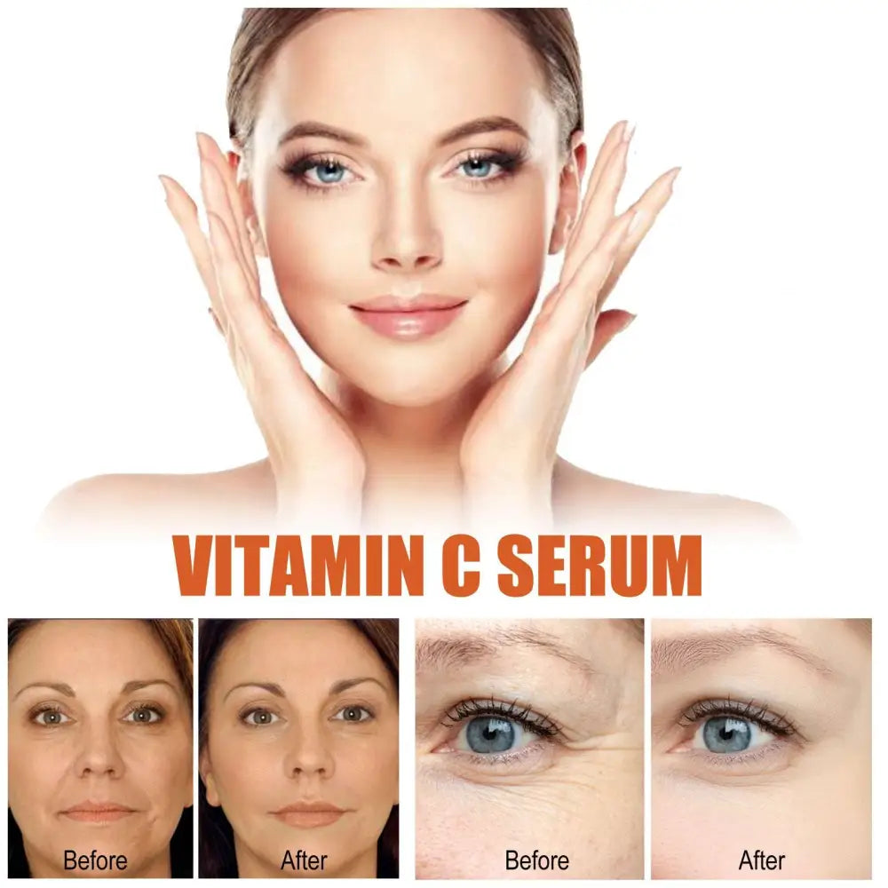 Anti-Aging Whitening Vitamin C Care Solution 30ml