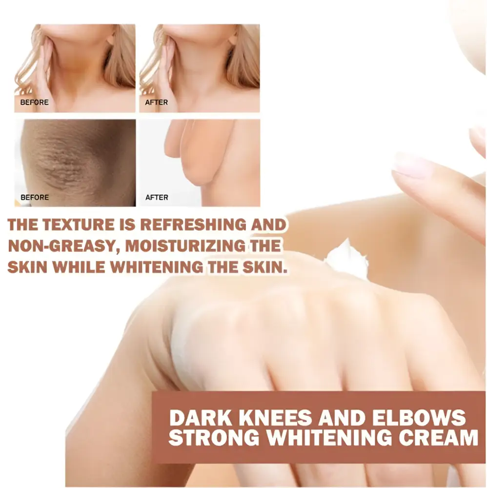 Eelhoe Joint Darkening and Brightening Cream