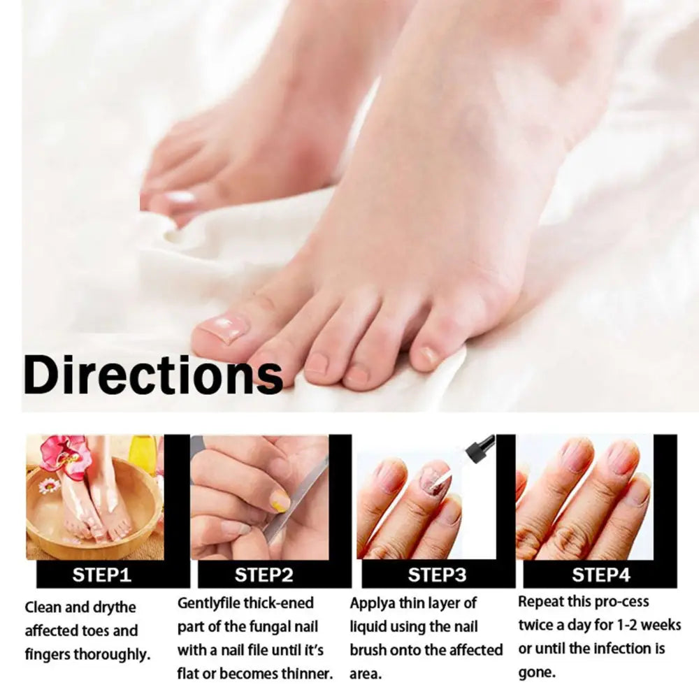 Eelhoe Nail Repair Liquid Fungal Treatment 50ml