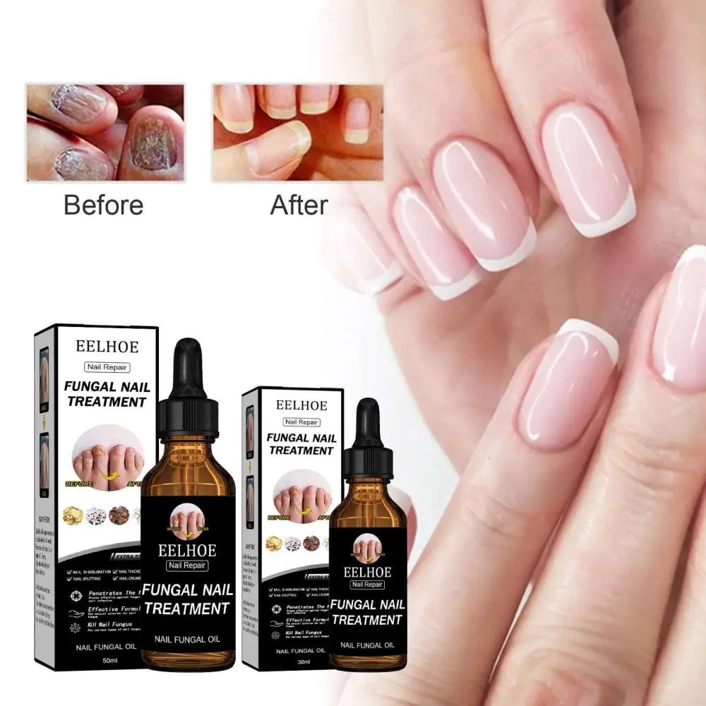 Eelhoe Nail Repair Liquid Fungal Treatment 50ml