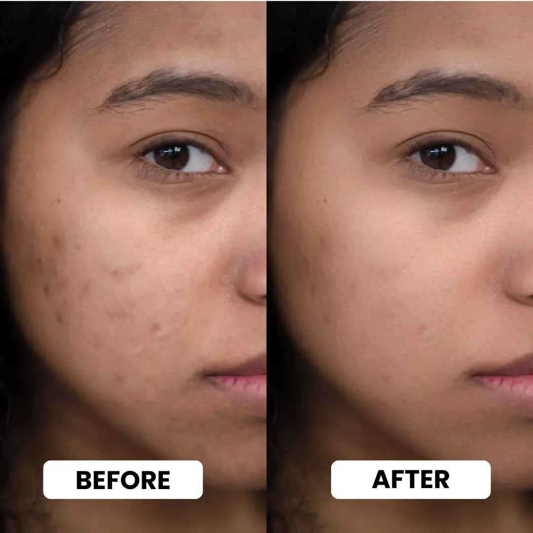 Skin Polish Wholesale-1
