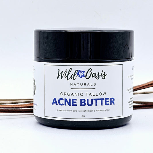 Acne Butter - Organic Tallow Acne Cream-0