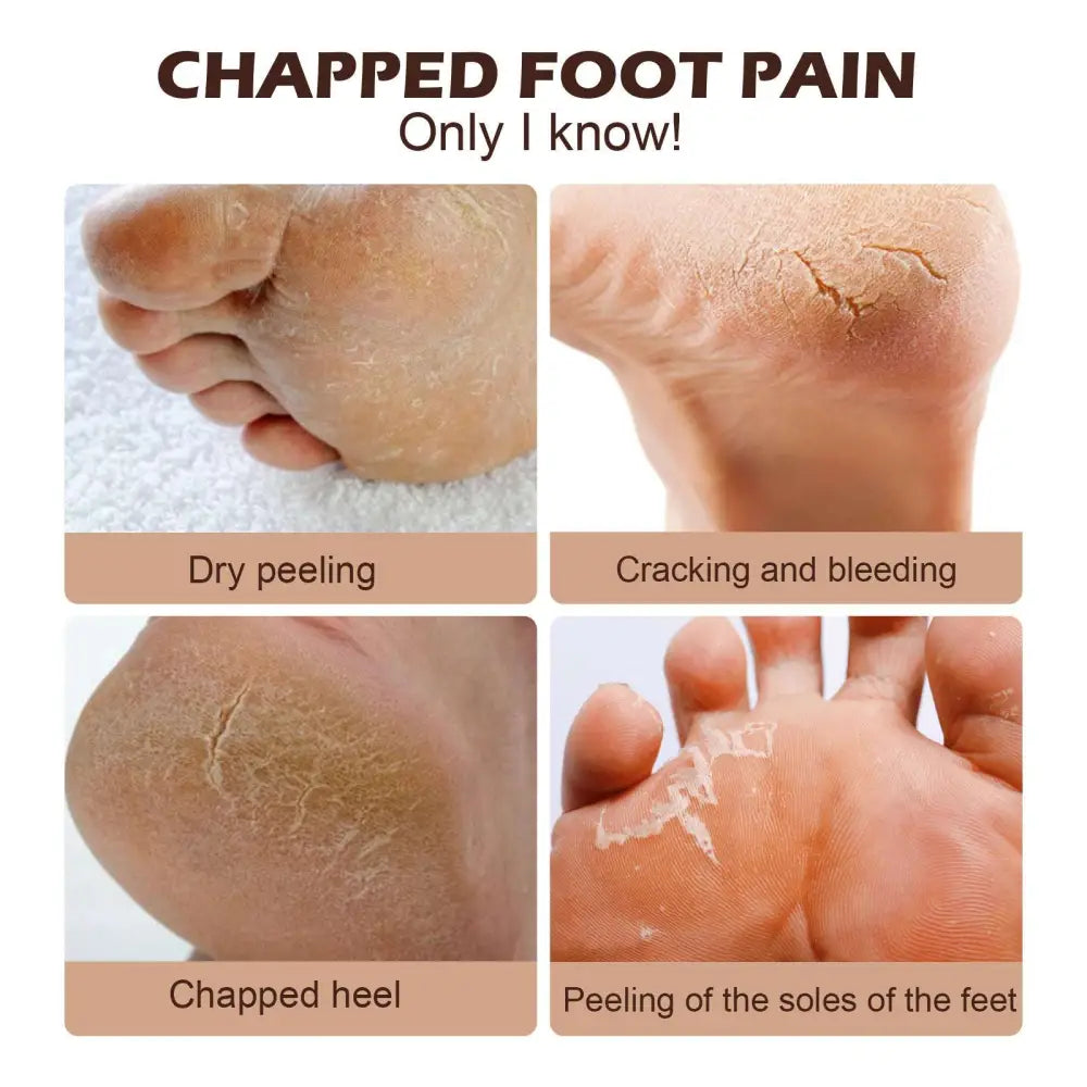 Horse Oil Foot Cream for Dry Cracked Feet