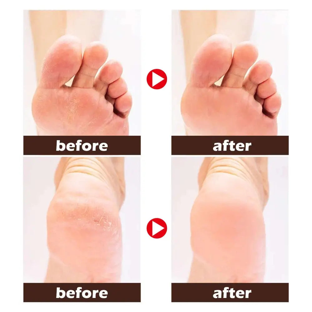 Horse Oil Foot Cream for Dry Cracked Feet