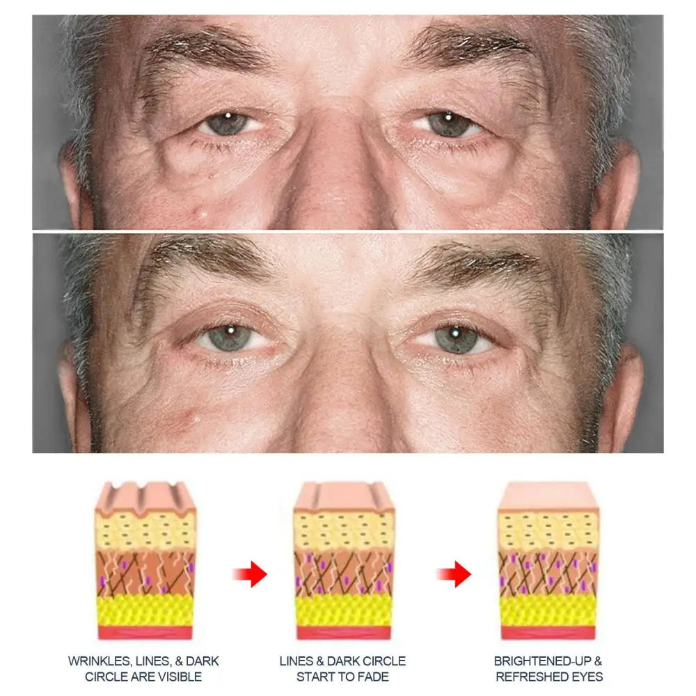 Men’s Anti-aging Eye Cream with Applicator Tip