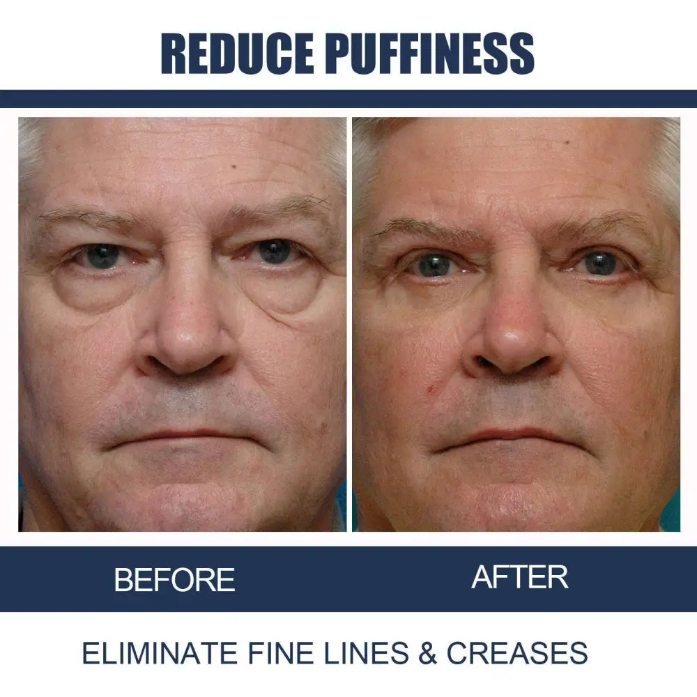 Men’s Anti-aging Eye Cream with Applicator Tip