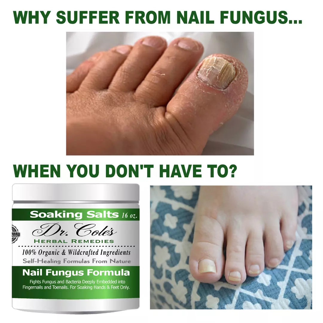 13 - Dr. Cole's Organic Nail Fungus Salts Formula-3