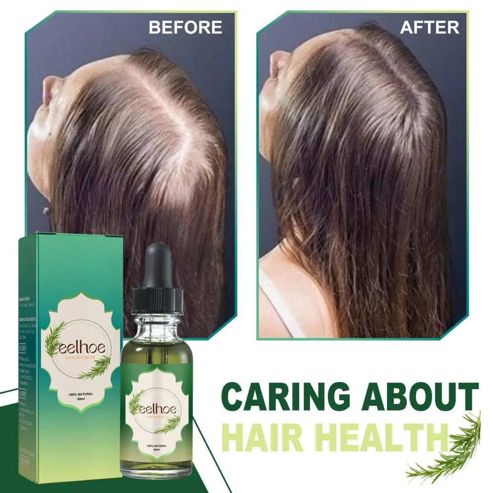 Nourishing Anti-hair Loss Hair Care Serum