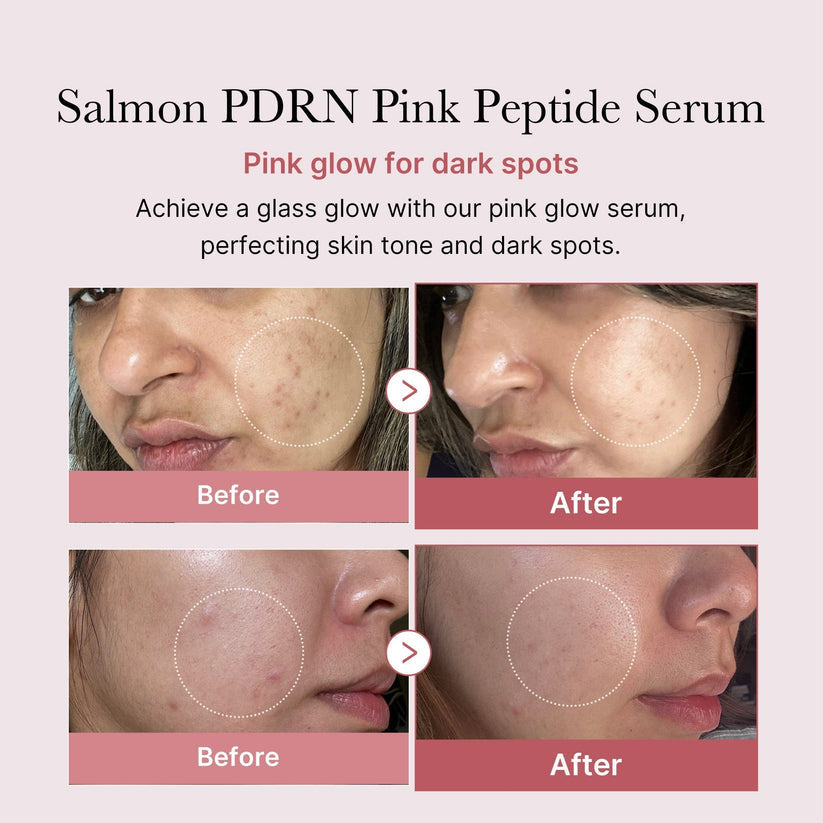 Medicube [NEW] PDRN Pink Peptide Brightening Glow Serum 30ml - Collagen Hydrating & Firming Essence for Radiant Skin | Moisturizing Anti Dullness Facial Serum