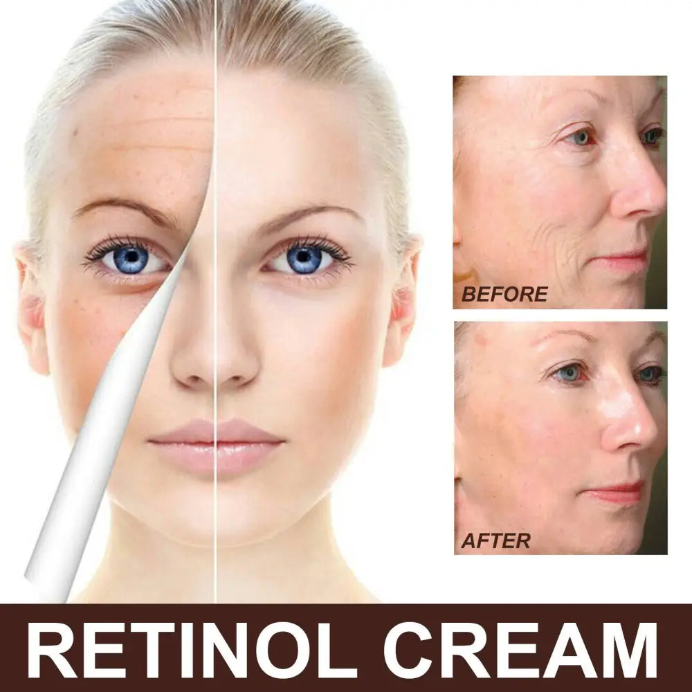 Retinol Anti Aging Skin Firming Cream