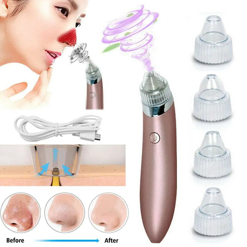 Rose Gold Electric Blackhead Vacuum with Strong Suction