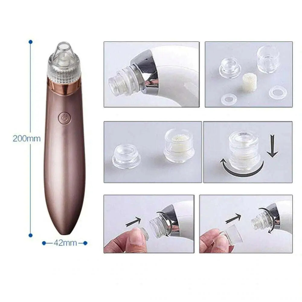Rose Gold Electric Blackhead Vacuum with Strong Suction