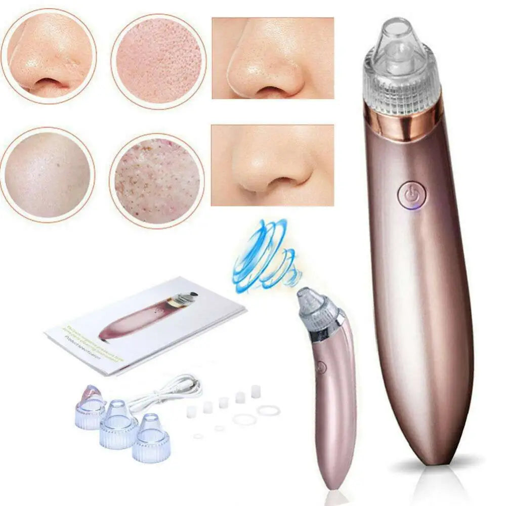 Rose Gold Electric Blackhead Vacuum with Strong Suction