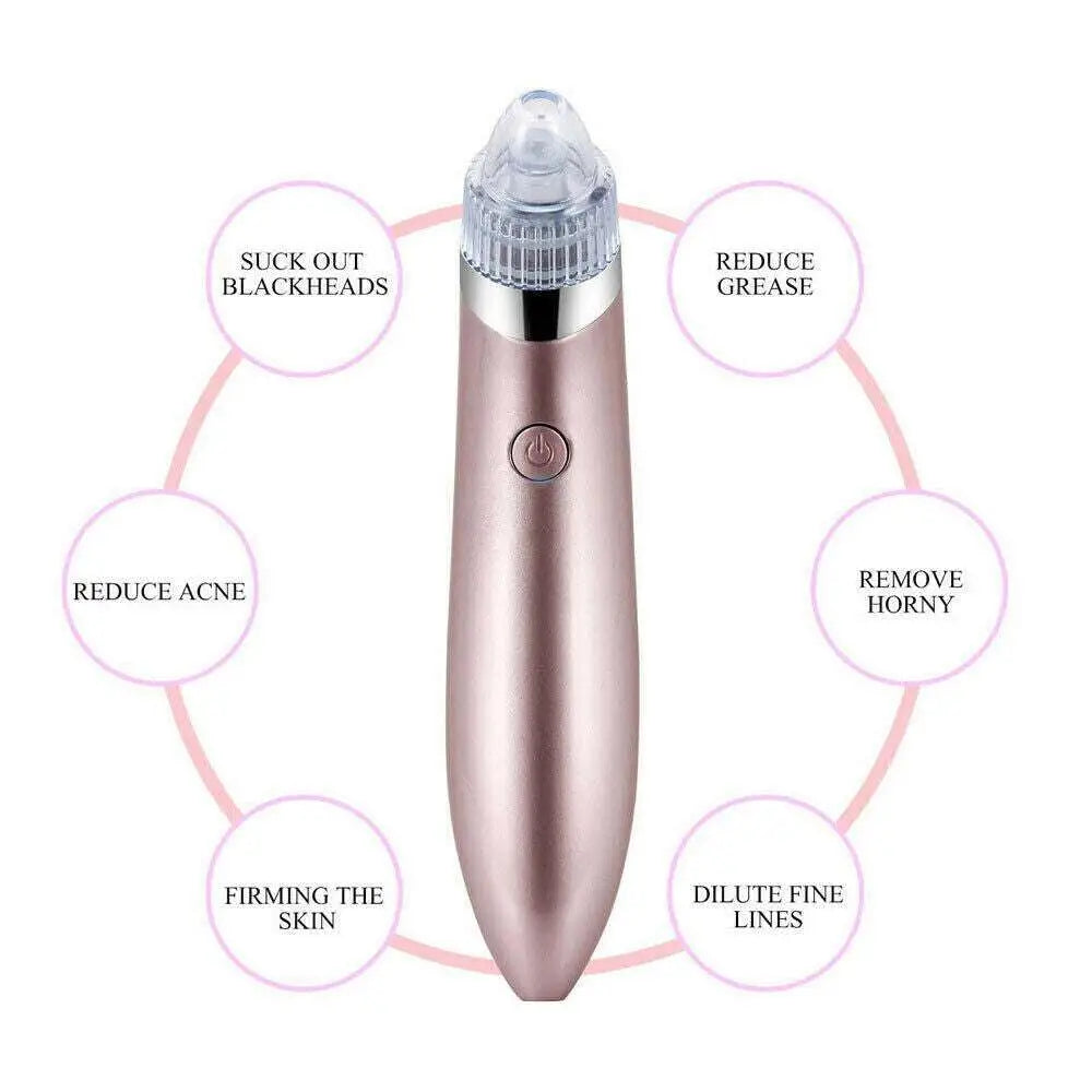 Rose Gold Electric Blackhead Vacuum with Strong Suction