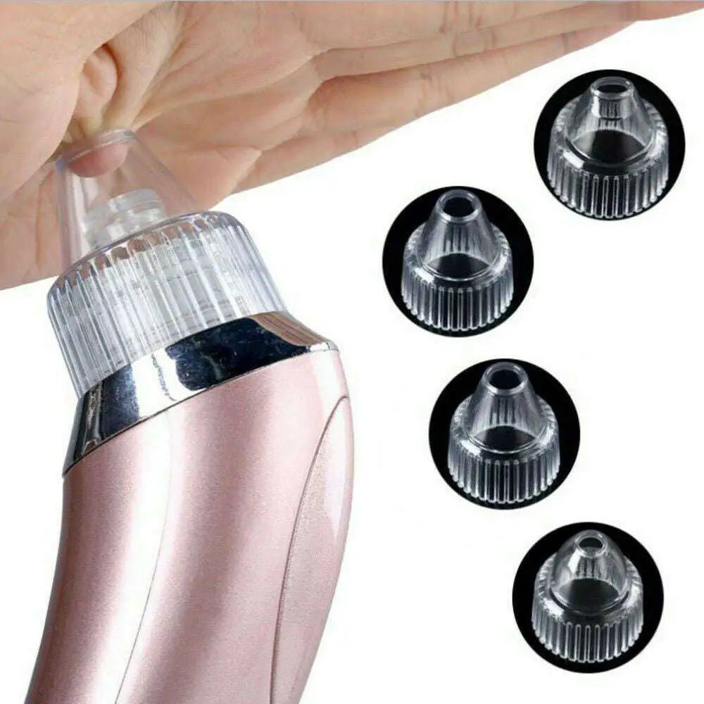 Rose Gold Electric Blackhead Vacuum with Strong Suction