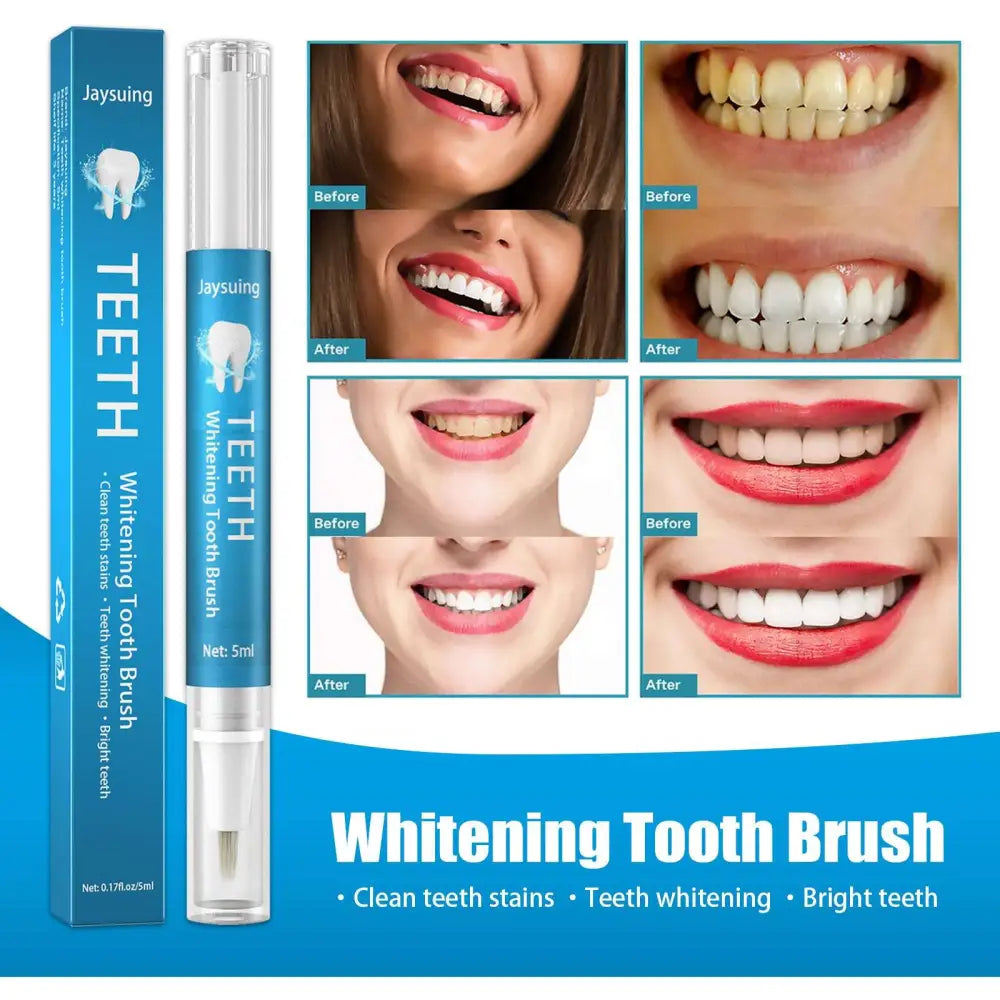 Teeth Whitening Pen for Stained Teeth and Plaque