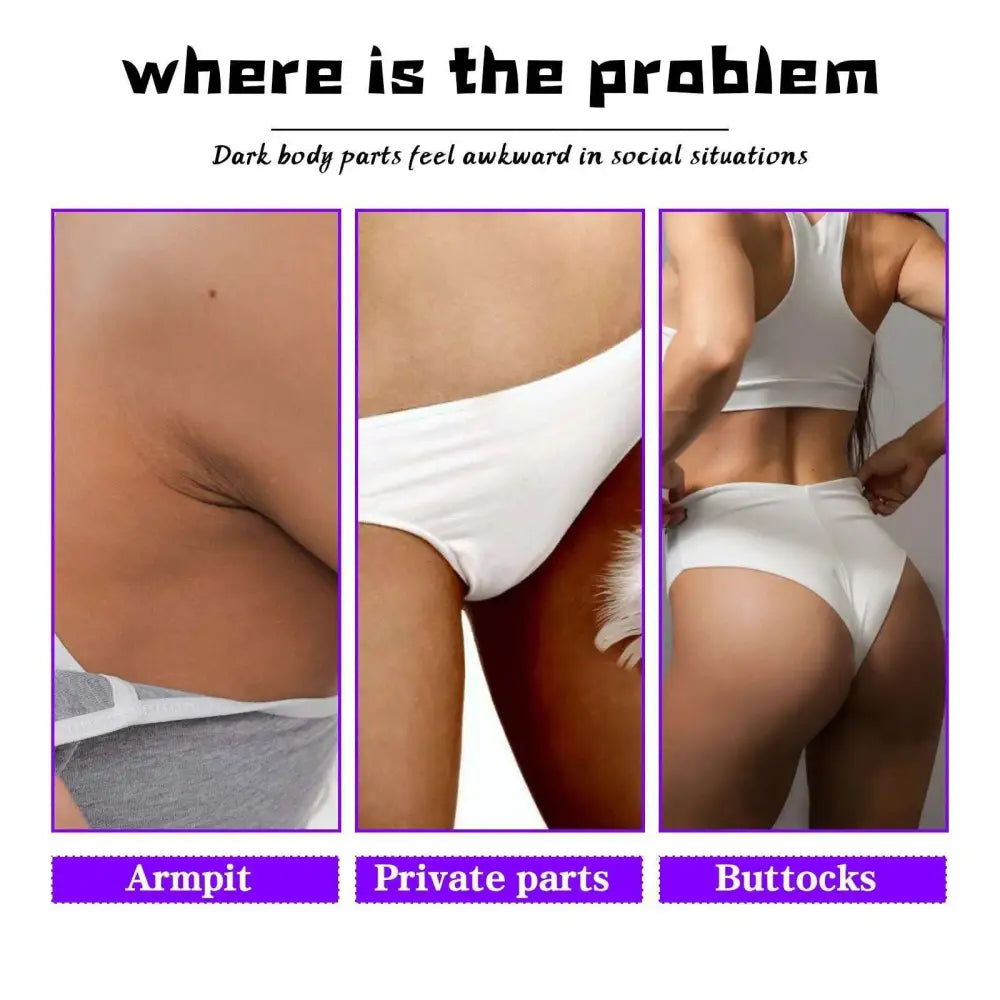 Thigh Skin Perfecting Cream Lightens Melanin