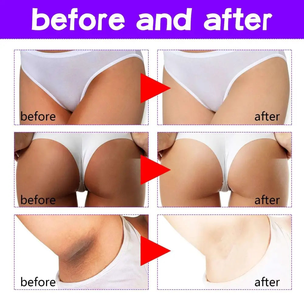 Thigh Skin Perfecting Cream Lightens Melanin