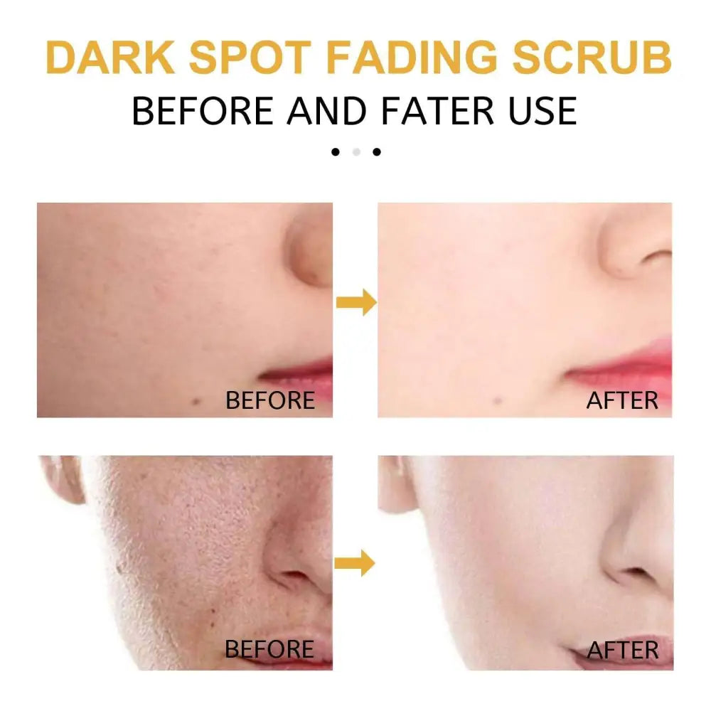 Turmeric Exfoliating Facial Scrub for Dark Spots