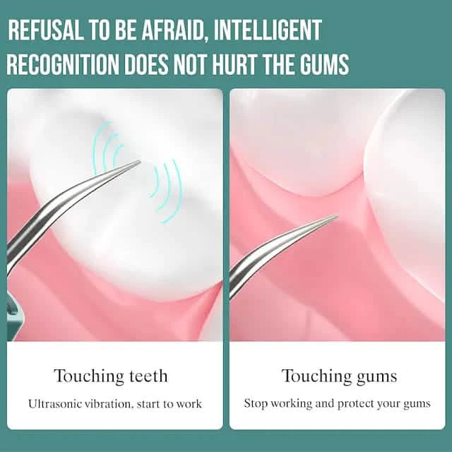 Visual Ultrasonic Teeth Cleaner